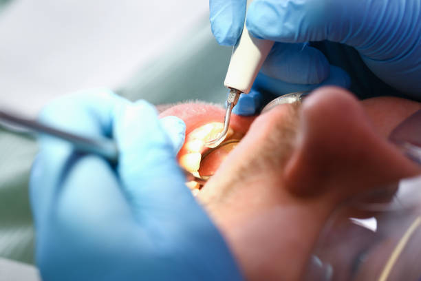 Best Urgent Tooth Repair  in Haslett, MI