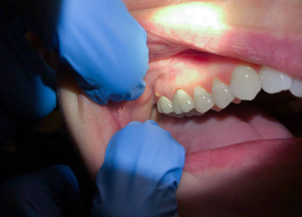 Best Cracked Tooth Emergency Dentist  in Haslett, MI
