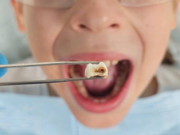Best Dentist for Tooth Abscess  in Haslett, MI